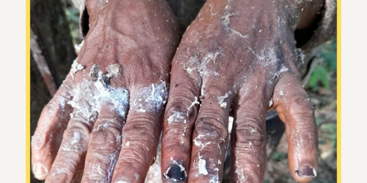 Guinée : Amnesty International dénonce de graves violations des droits des travailleurs à la Soguipah